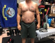 Surgery